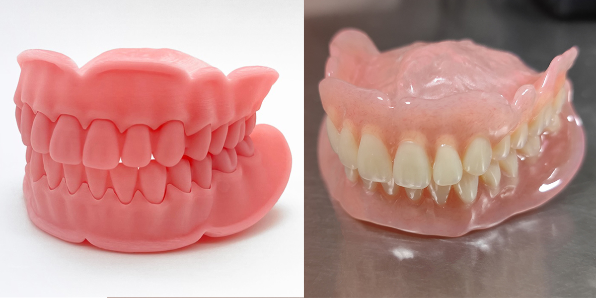 3D печать воском в стоматологии